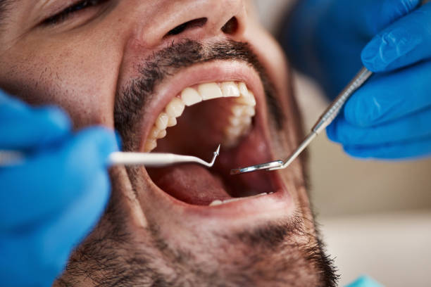 Best Emergency Denture Repair in Yazoo City, MS
